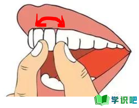 牙龈萎缩怎么恢复？ 第1张