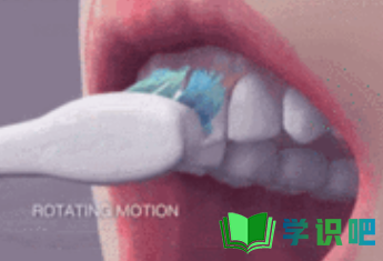 牙龈萎缩怎么恢复？ 第5张