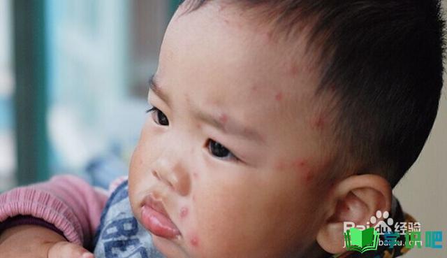 宝宝出水痘应该如何护理？