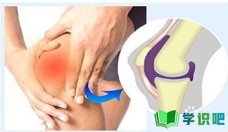 膝关节疼是怎么回事？ 第6张