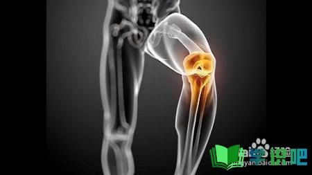 膝关节疼是怎么回事？ 第7张