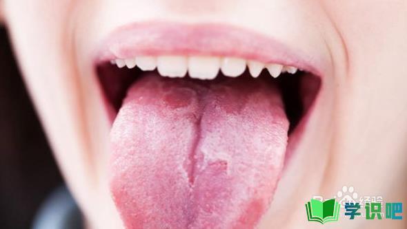 舌裂纹怎么清洁？ 第1张