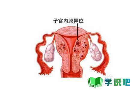 女性经期后有褐色分泌物是怎么回事？
