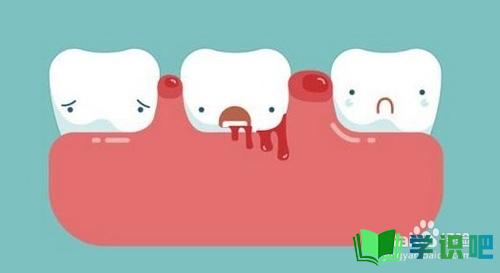 刷牙出血怎么办？