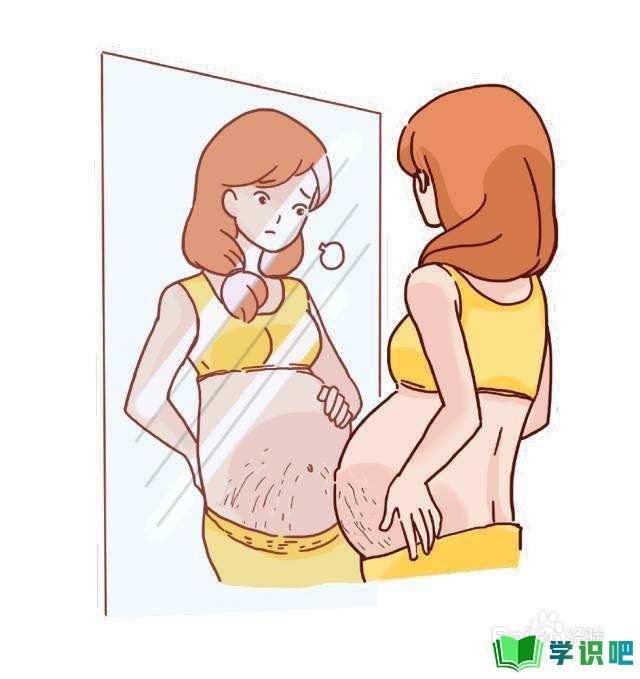 肚子有妊娠纹怎么办？ 第6张