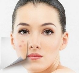 化妆品导致的皮肤过敏怎么办？ 第2张