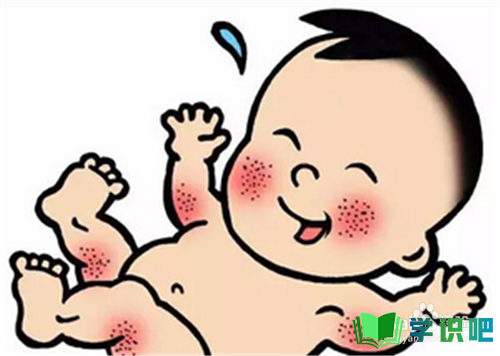 两个半月宝宝湿疹怎么办？ 第2张