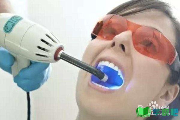 洗牙后牙齿松动怎么办？ 第3张
