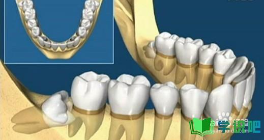 哺乳期长智齿牙龈肿痛怎么办？