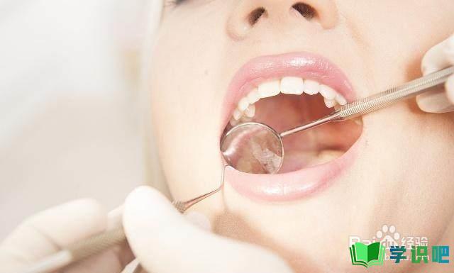 哺乳期长智齿牙龈肿痛怎么办？ 第6张
