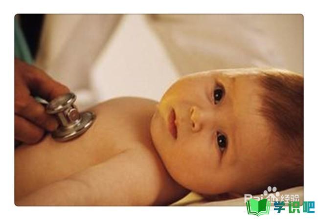 新生儿发生黄疸怎么办？ 第6张