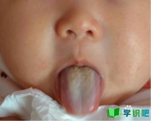孩子舌苔厚白怎么办？