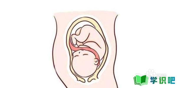 孕后期胎位不正脐带绕颈怎么办？ 第2张