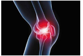 膝盖负重后痛怎么办？