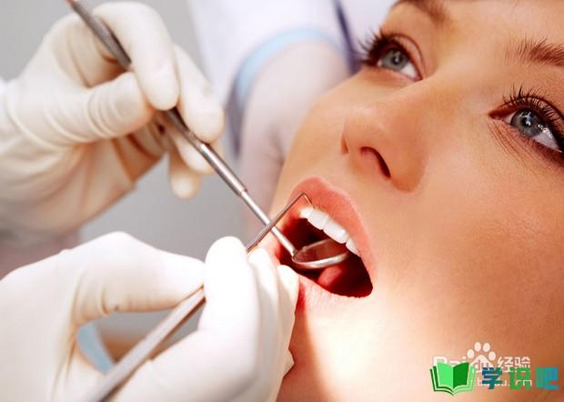 牙龈出血怎么办保护牙齿有妙招？ 第6张