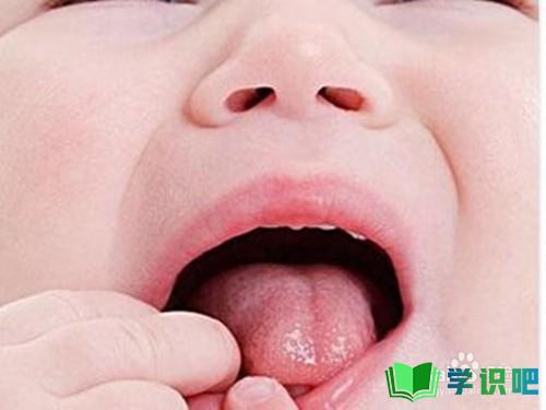 八个月大宝宝口腔舌头上有红点怎么办？ 第4张